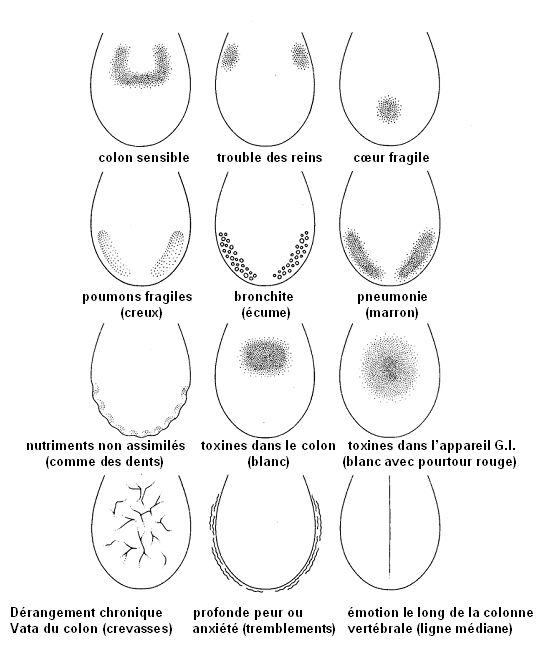 Quelques types de désordres et leurs manifestations